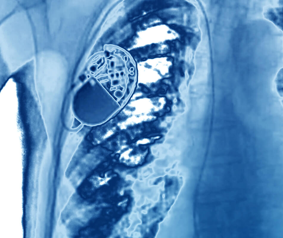 therapeutics